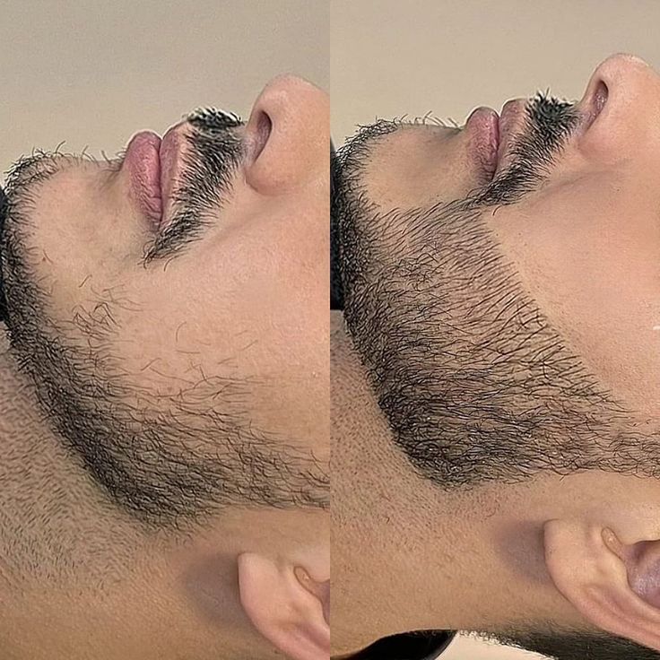 BEARD GROWTH SERUM