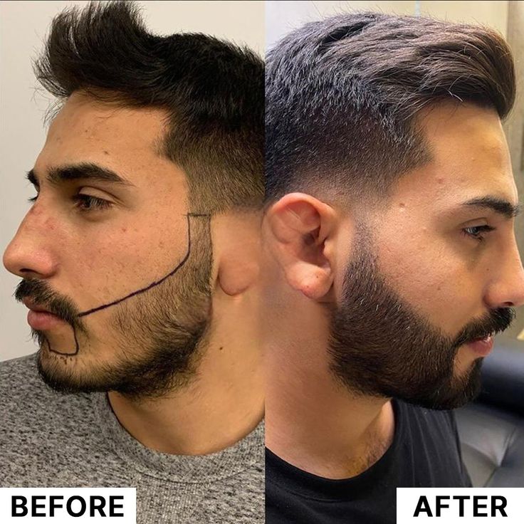 BEARD GROWTH SERUM